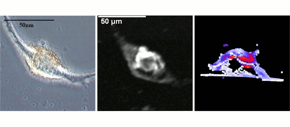 Acoustic and photoacoustic investigation of cell nanoparticle interaction